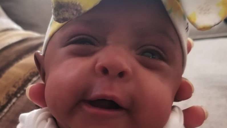 8.6 Ounce Baby, The World’s Tiniest Surviving Baby, Released  From California Hospital