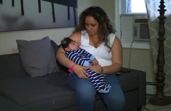 baby with exencephaly
