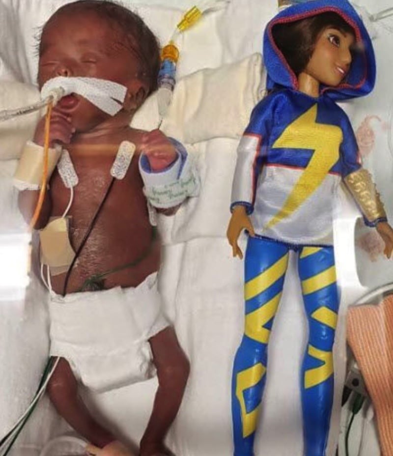 Arizona Baby Girl Born Weighing 13.1 Ounces Heads Home With Family!