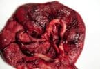 Your Placenta - What Does It Do and How Does It Grow Your Baby?
