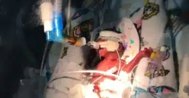 Baby Latifa born at 23 weeks 250gm