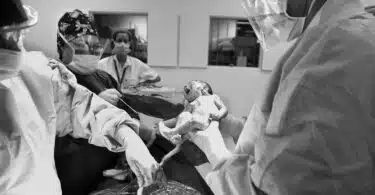 Could Delaying Umbilical Cord Clamping Reduces Disability Risk in Premature Babies?