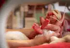 premature baby