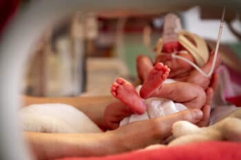 premature baby