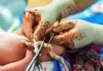 Cutting the umbilical cord between a newborn baby and placenta