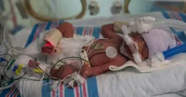 23 Week Baby Thought To Be Dead Found Breathing In Box