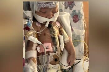 Yesenia Rangels son Micah after surgery