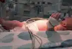 premature baby in NICU
