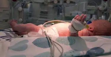 premature baby in NICU