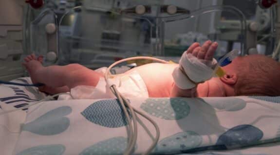 premature baby in NICU