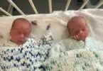 Jacob and Jaxon James at University Hospitals of North Midlands