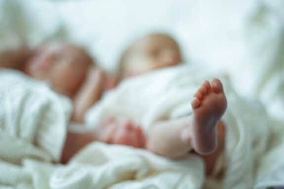 Rare Simultaneous Twins Born at the Same Time Amaze Doctors