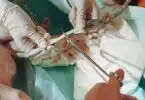 A doctor holds a new born baby whilst another doctor cuts the Umbilical cord.