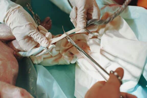 A doctor holds a newborn baby whilst another doctor cuts the Umbilical cord.