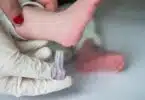 nurse performing the neonatal heel prick test