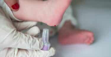 nurse performing the neonatal heel prick test