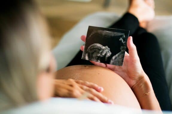 pregnant woman holding ultrasound picture