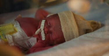 premature baby NICU