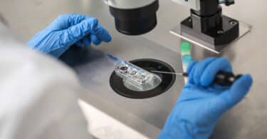 Checking result of in vitro fertilization