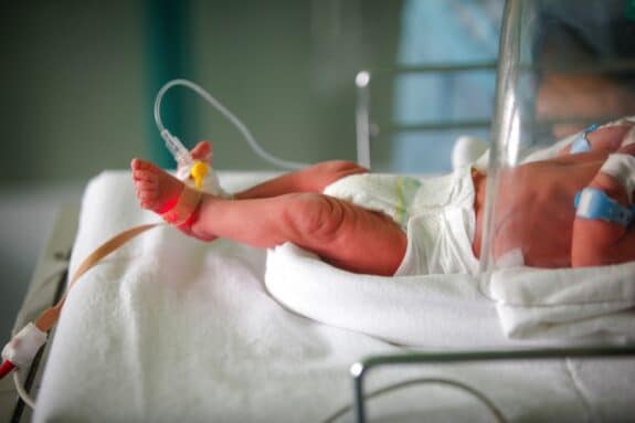 premature baby in NICU isolette