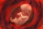 Human Fetus in the womb