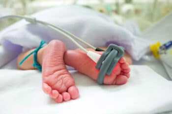 newborn Pulse Oximetry Screening