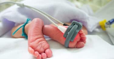 newborn Pulse Oximetry Screening