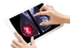 X-ray Digital Mammogram both breast MLO