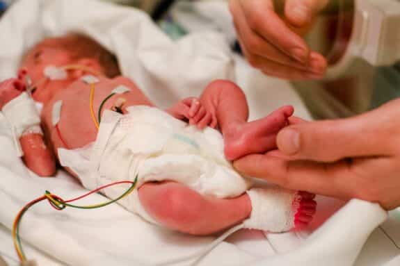Premature baby lies in the incubator