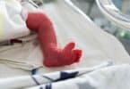 Small newborn is placed in a premature newborn incubator