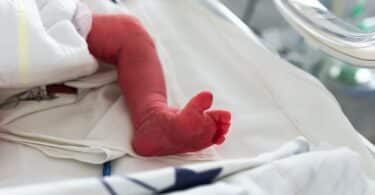 Small newborn is placed in a premature newborn incubator