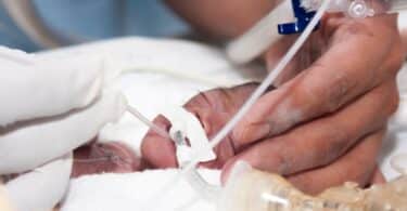 extremely premature baby incubator