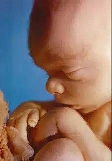 36 week fetus