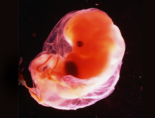 5 week embryo