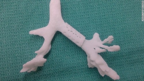 A model of Kaiba's airway, with the biological stent in place