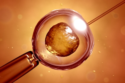 Assisted reproductive technology