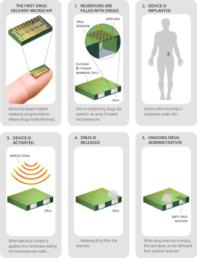 Birth Control microchip