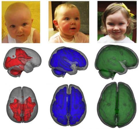 MRI images, taken while children were asleep, showed that infants who were exclusively breastfed for at least three months. Image VIA Brown University