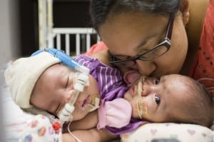 Elysse Mata with her conjoined twins Knatalye and Adeline