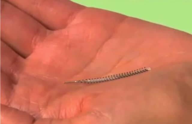 Essure Birth Control