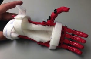 Holden Mora's 3d printed hand