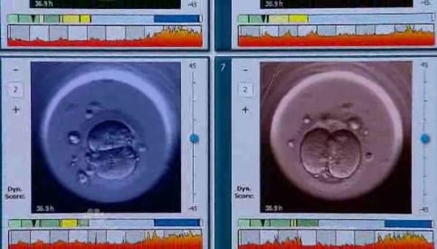 IVF Imaging