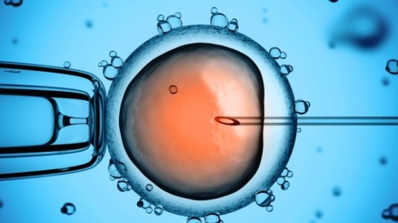 IVF image