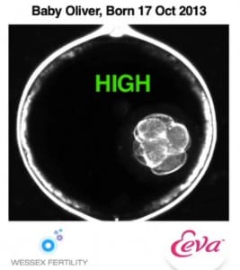 IVF time lapse photo