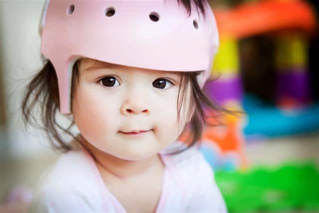 Infant orthotic helmet
