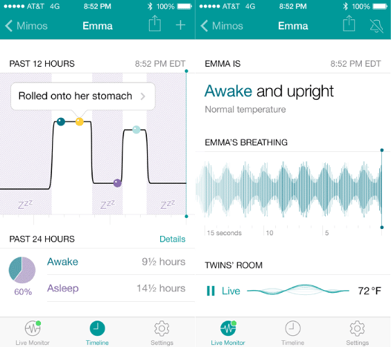 Mimo baby monitor