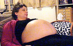 Moms cyst causes her to gain over 100 pounds while pregnant