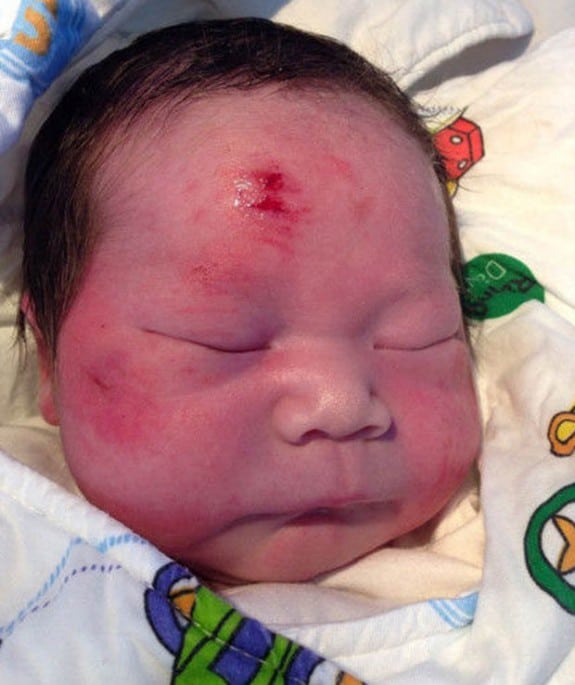 Newborn Xiao Zhao born after parents were in a car accident