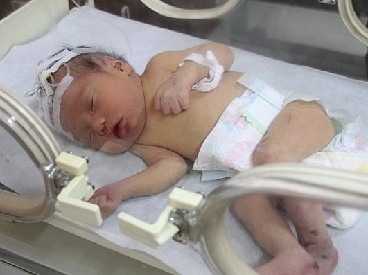Newborn rescued from Sewer in hospital China