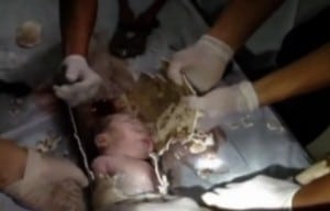 Newborn stuck in Sewer China